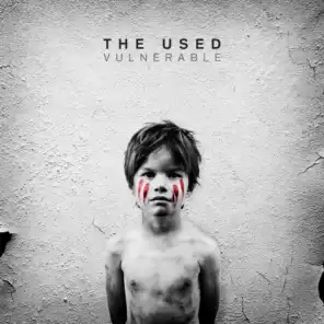Vulnerable (Deluxe Version)