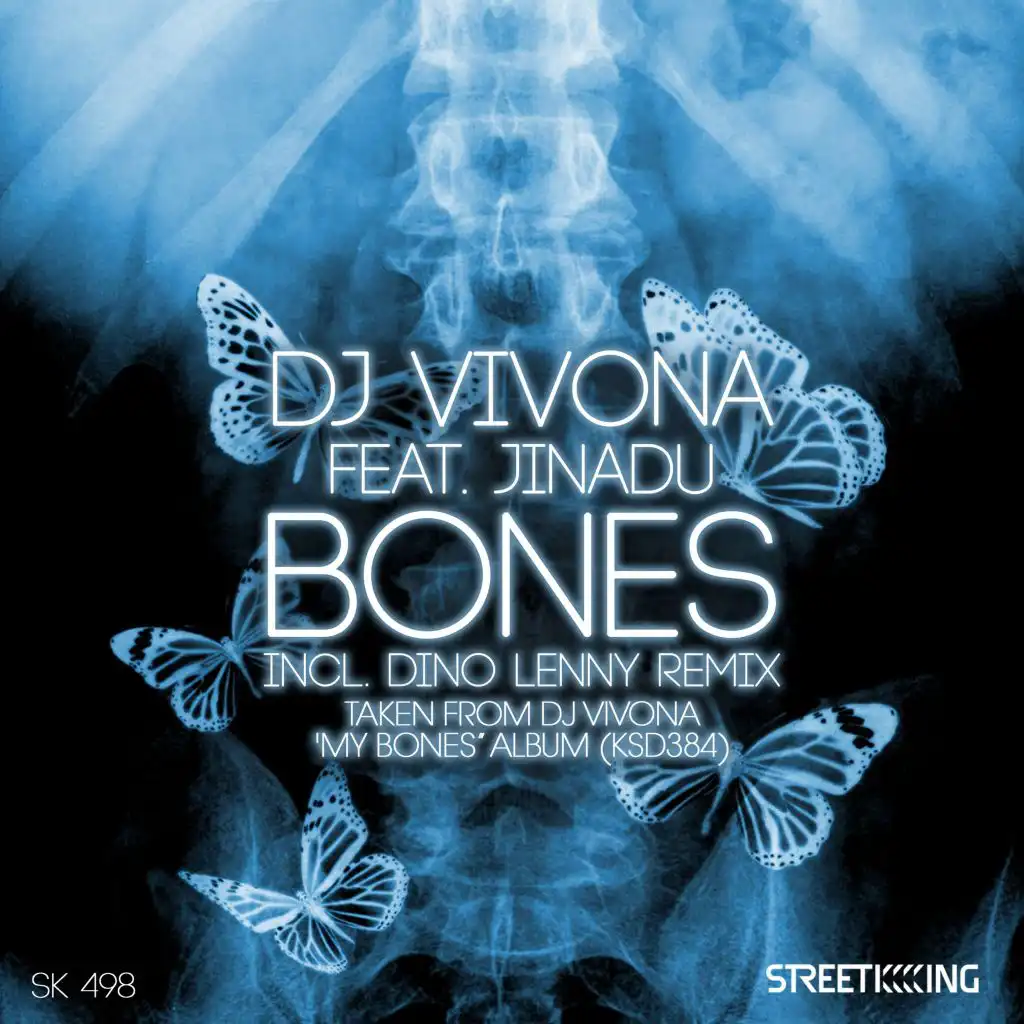 Bones (Dino Lenny Remix) [feat. Jinadu]