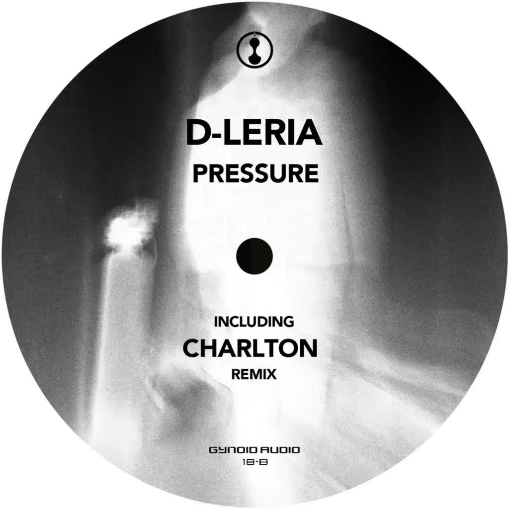 Pressure (Charlton Remix)