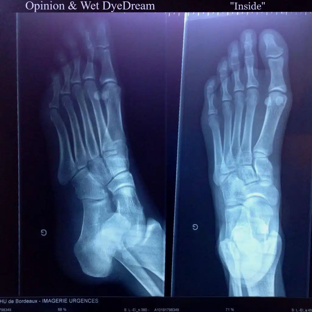 Inside With Wet DyeDream