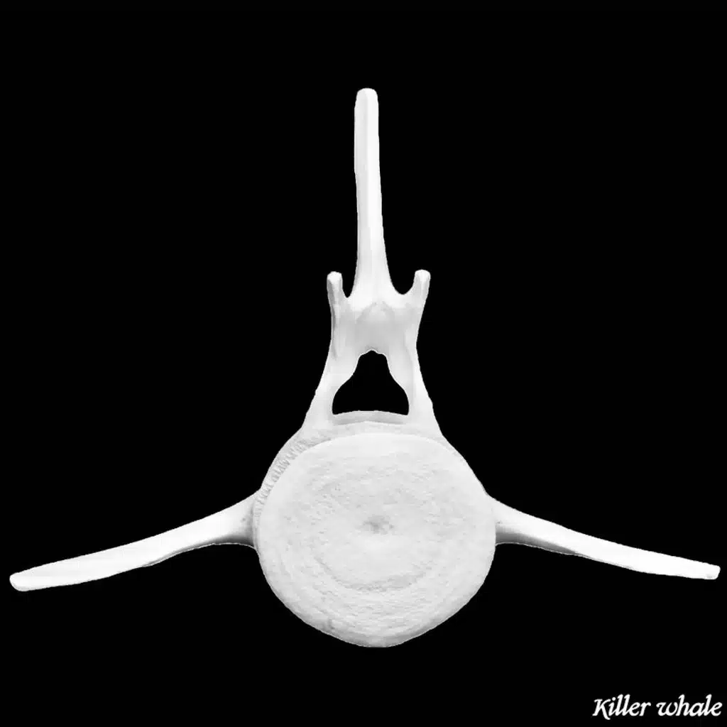 Bare Bones