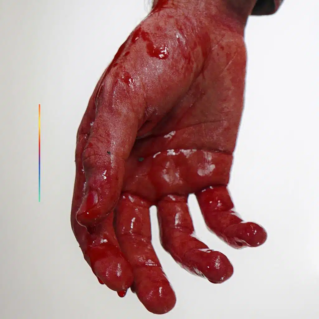 You’re So Beautiful It Hurts