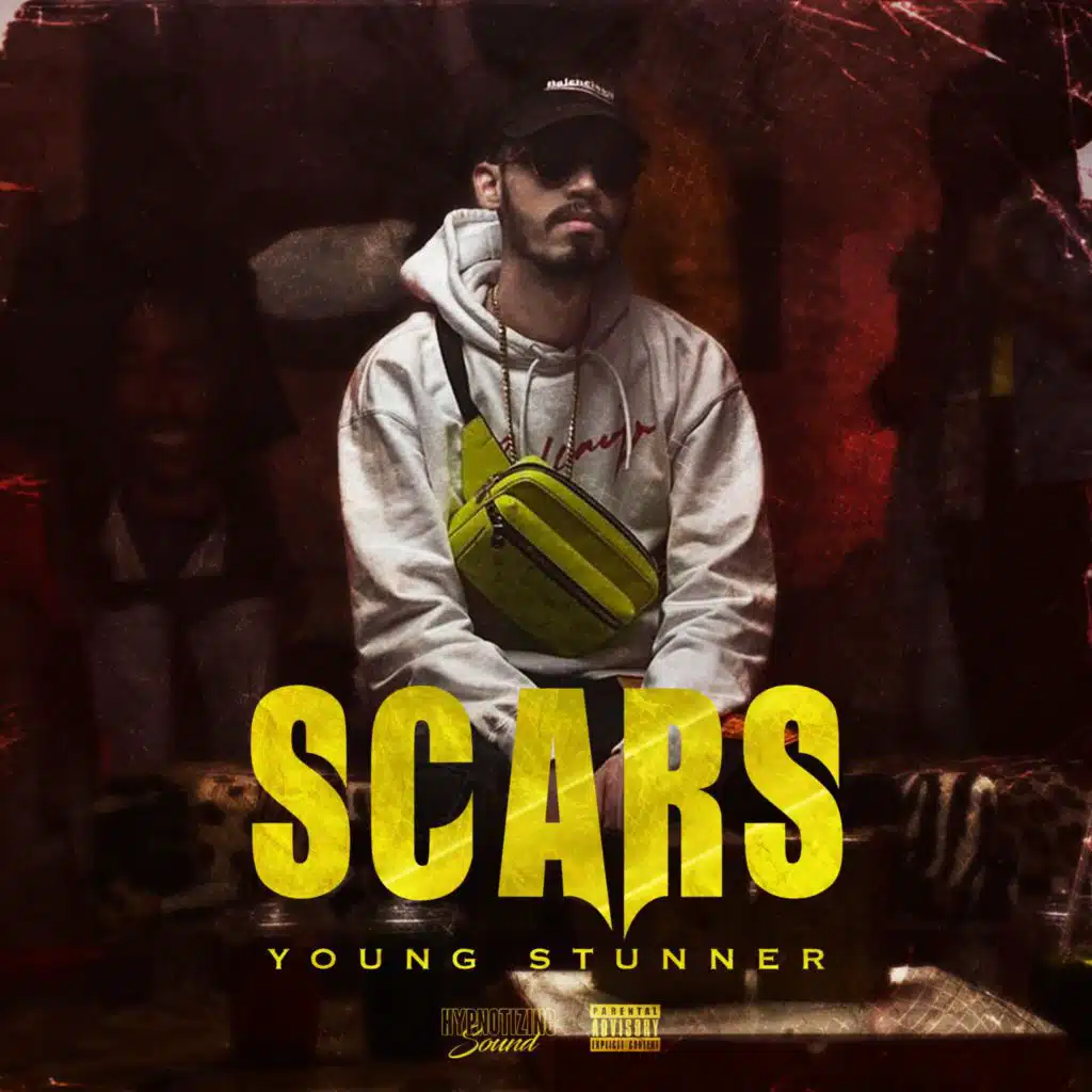 Scars