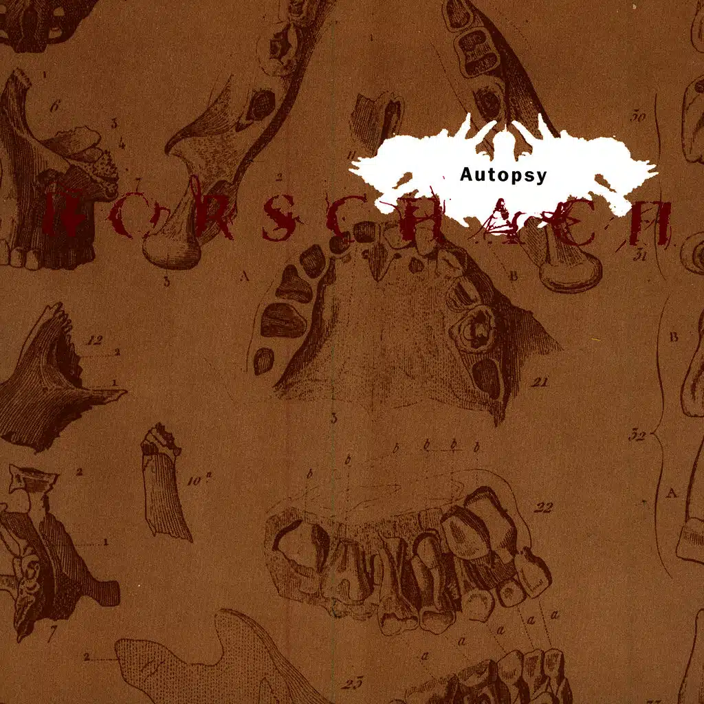 Autopsy