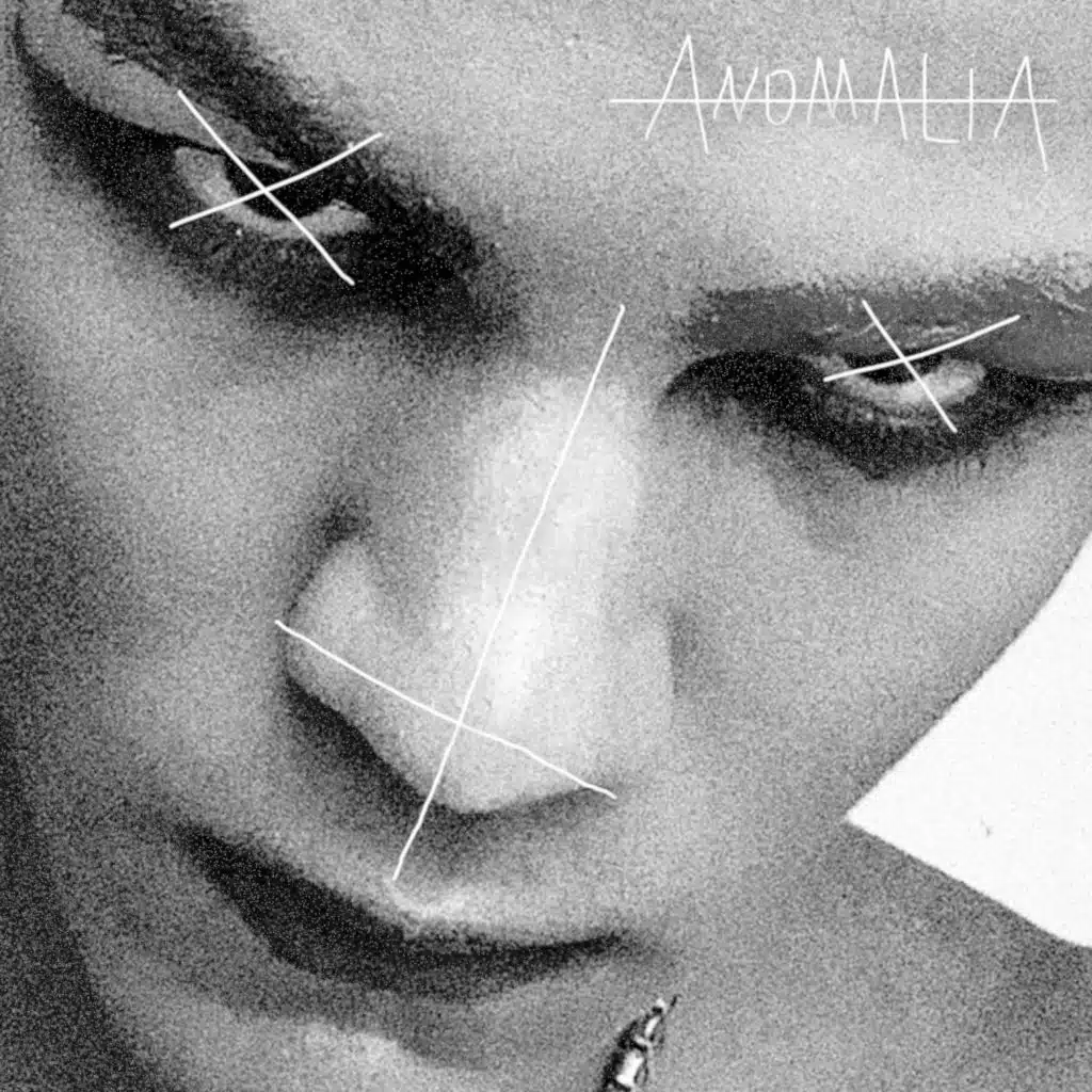 Anomalia