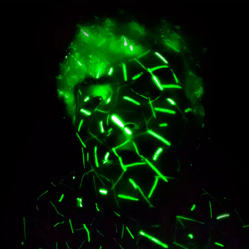 Anomalia