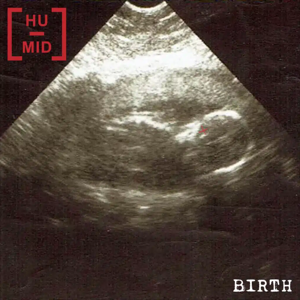 Birth
