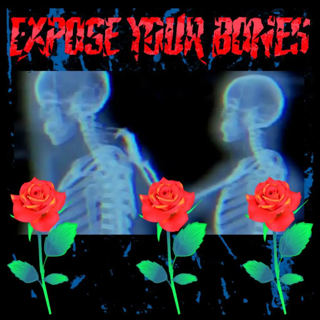 EXPOSE YOUR BONES