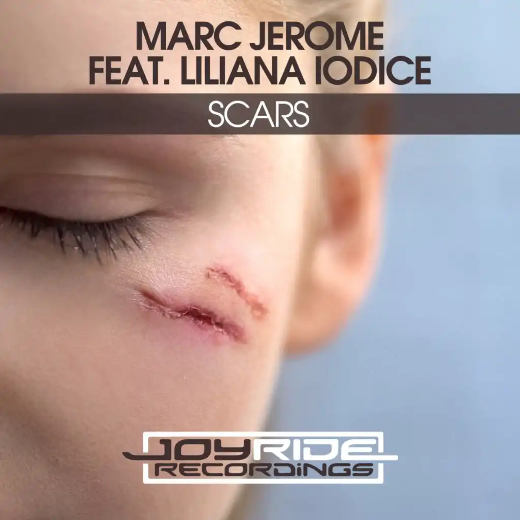 Scars (Radio Mix) [feat. Liliana Iodice]