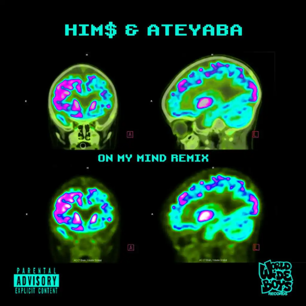On my Mind (feat. Ateyaba) (Remix)