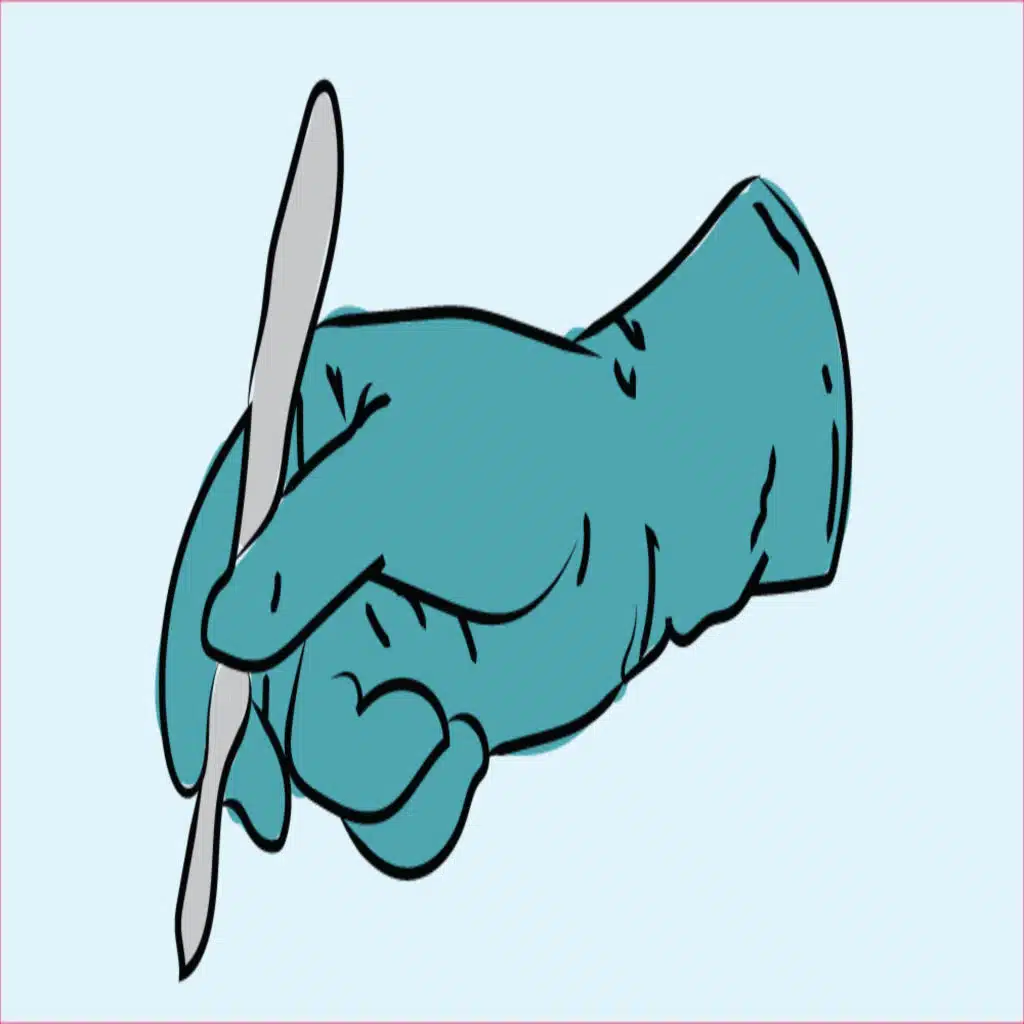 23. Post-Operative Complications