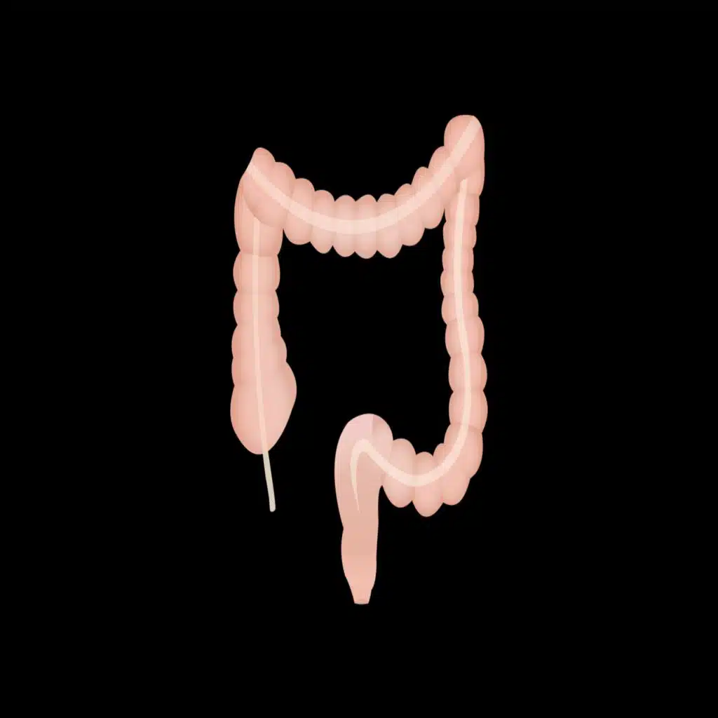 6. Bowel obstruction