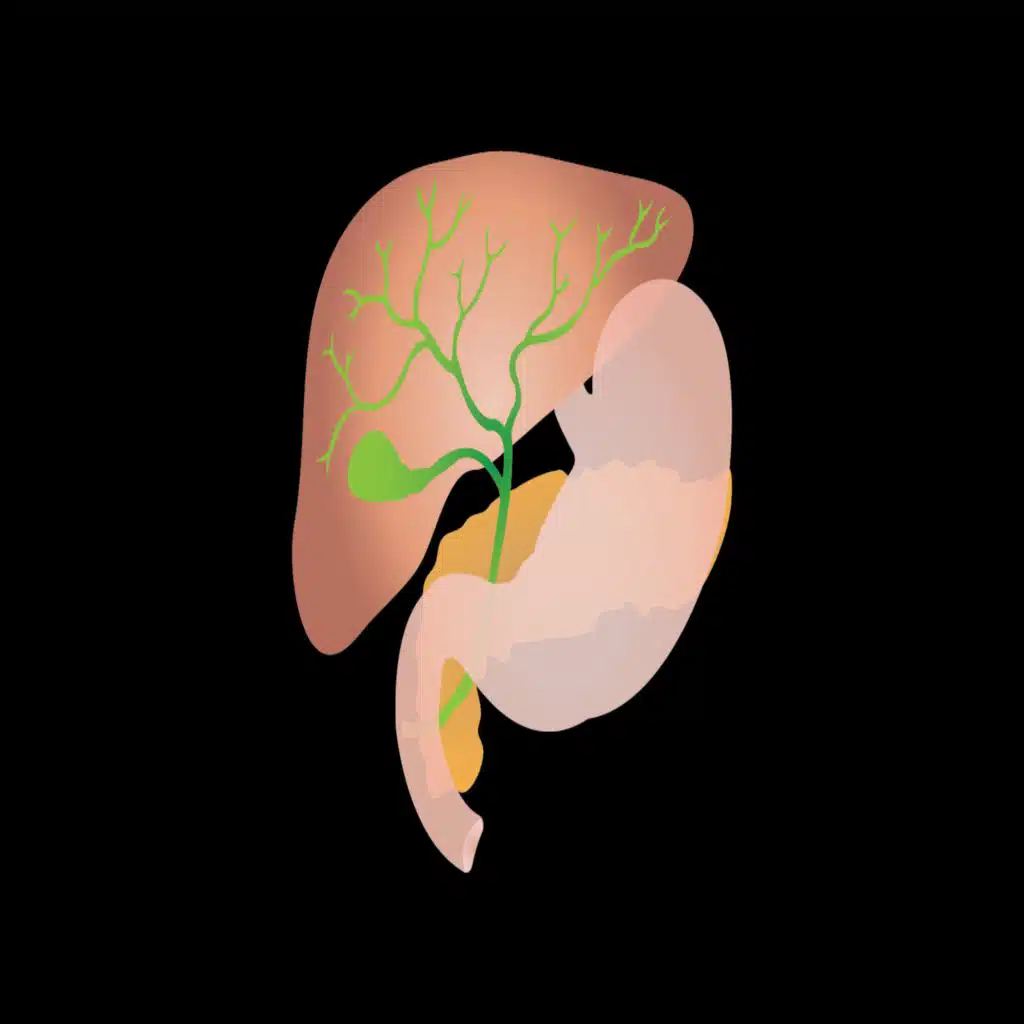 247. Laparoscopic Cholecystectomy