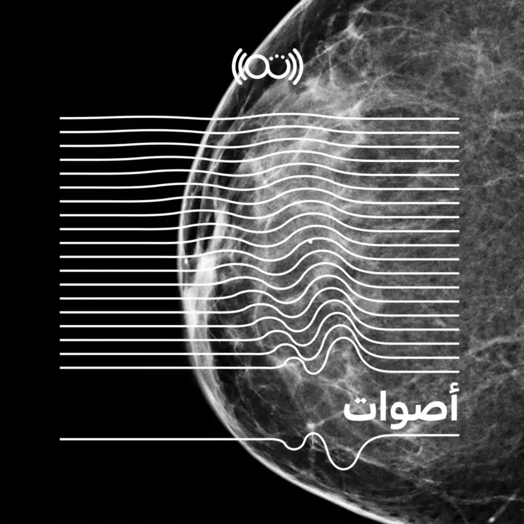 خذ خزعة