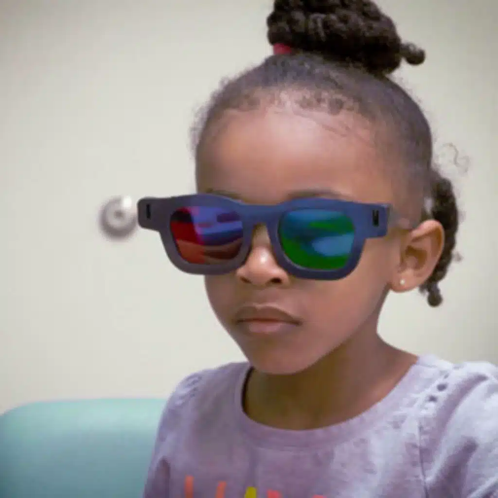 Binocular iPad Game vs Patching for Treatment of Amblyopia in Children