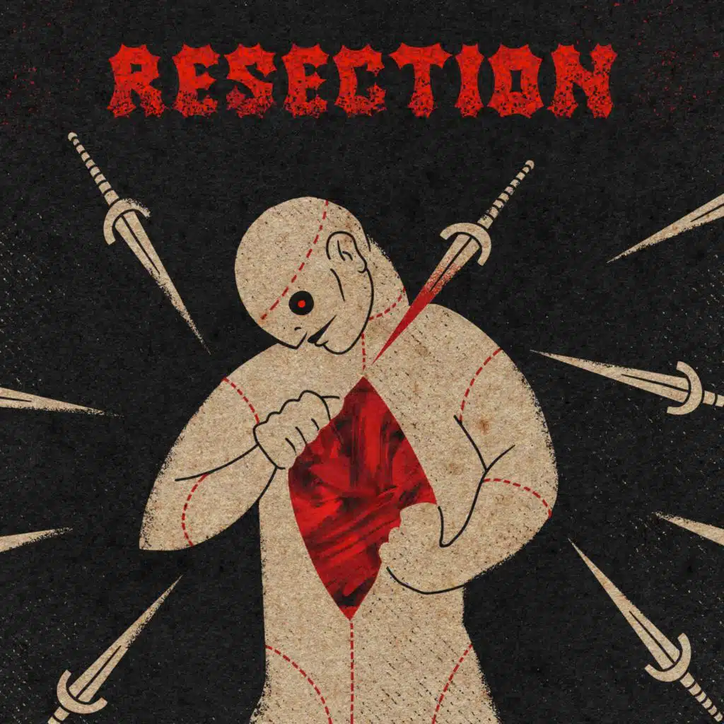 Resection
