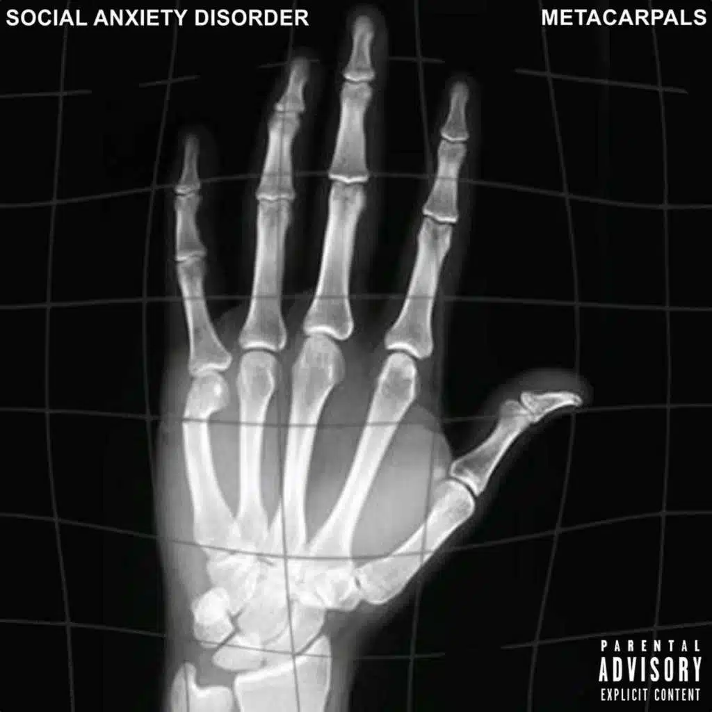 Metacarpals
