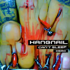 Hangnail