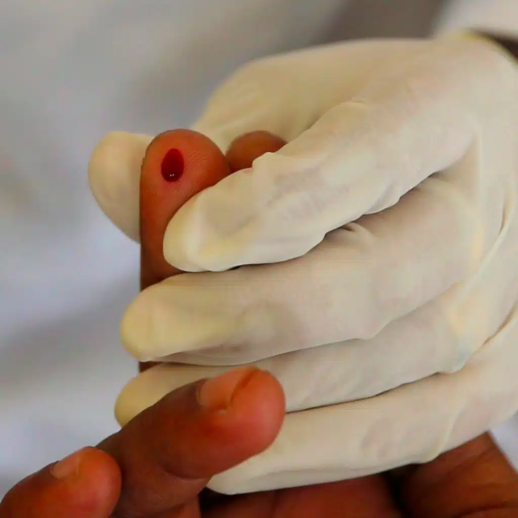 Ending the HIV stigma