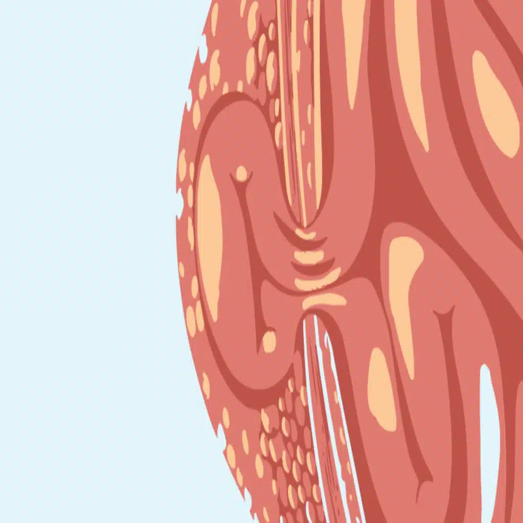 332. Hernia Basics and Spigelian Hernias