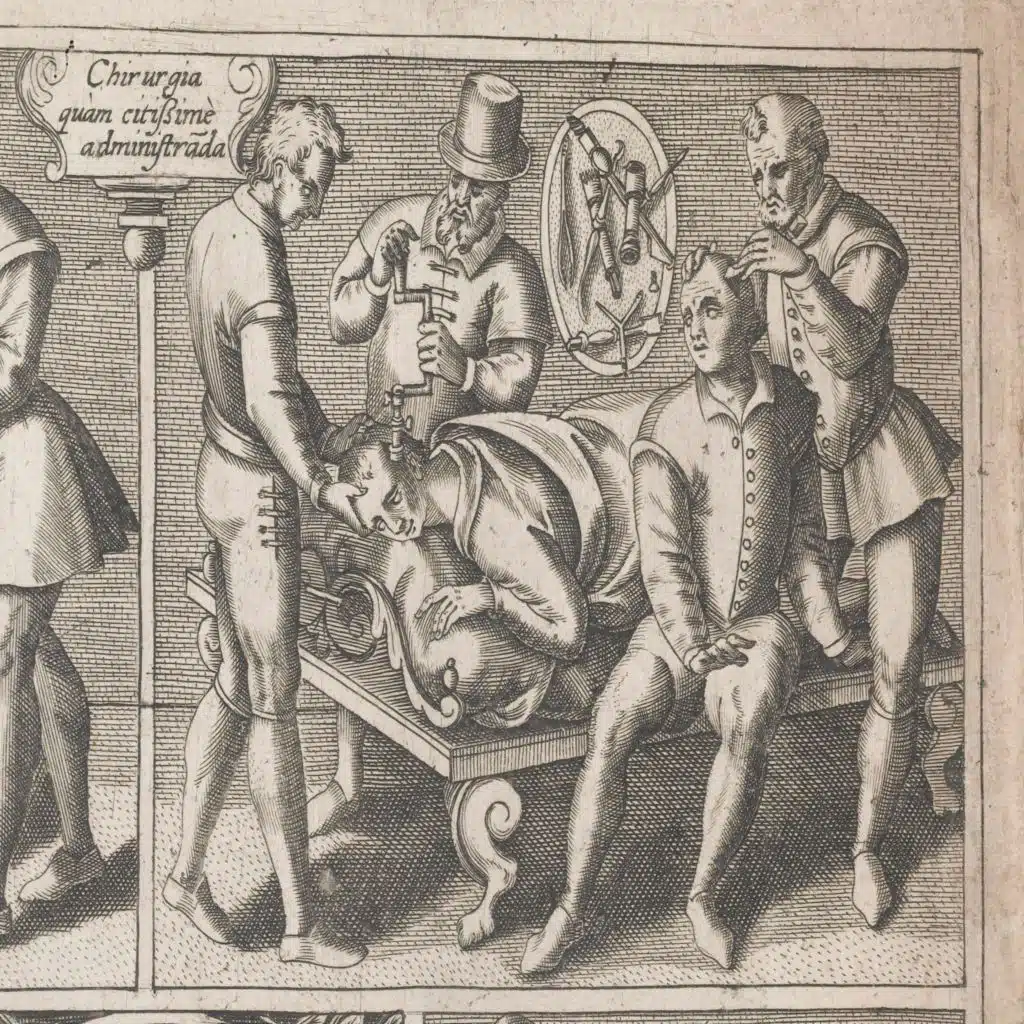 When a Hole in the Head is a Good Thing