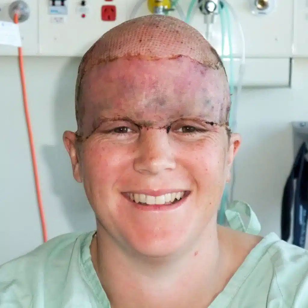 "I was scalped at 13 weeks pregnant"