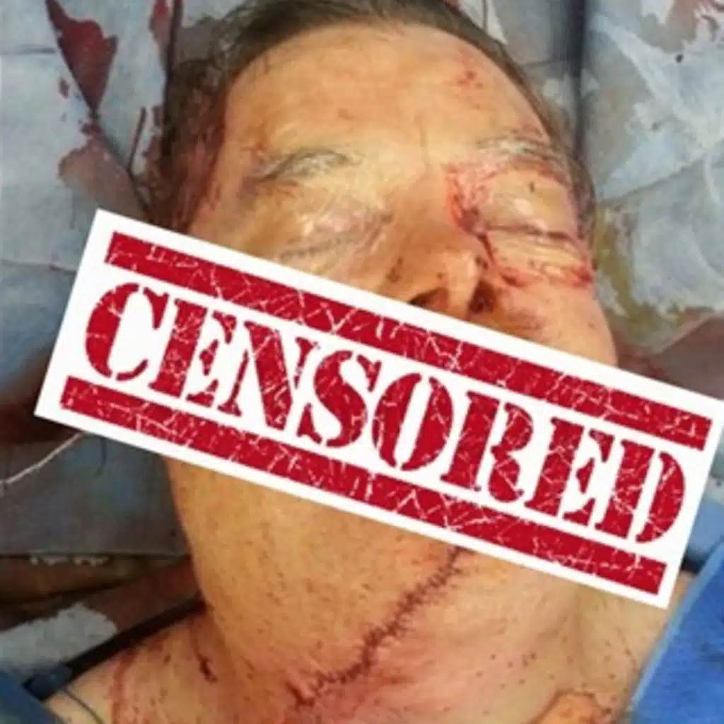 I sliced off my face with a chainsaw!