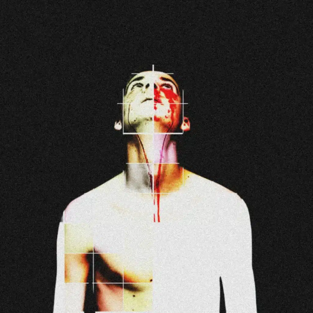 Нервный Тик