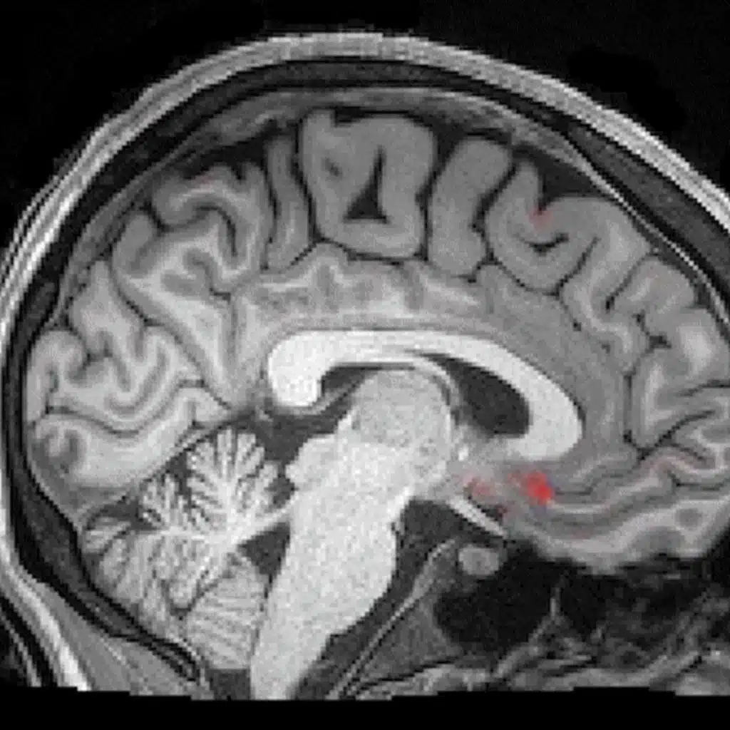 Just 10 seconds and deep sleep immediately with delta brainwaves music