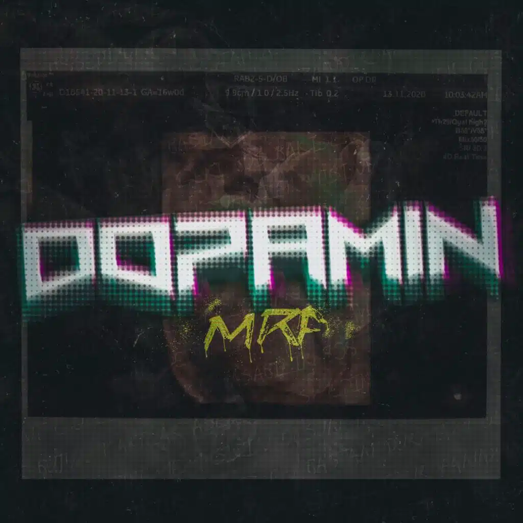 Dopamin