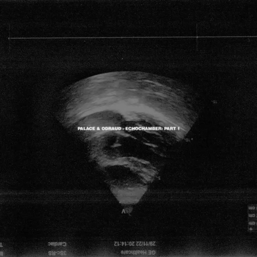 ECHO CHAMBER: PART 1