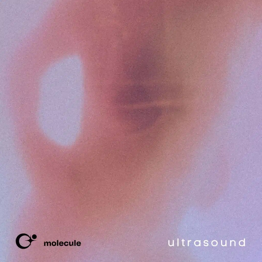 ultrasound
