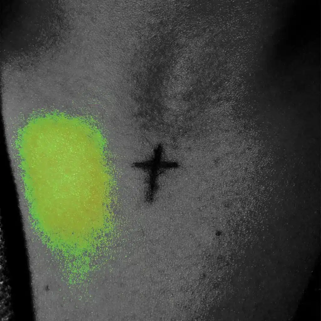 VULNERABLE (CURSE) (feat. CITIxZZEN)