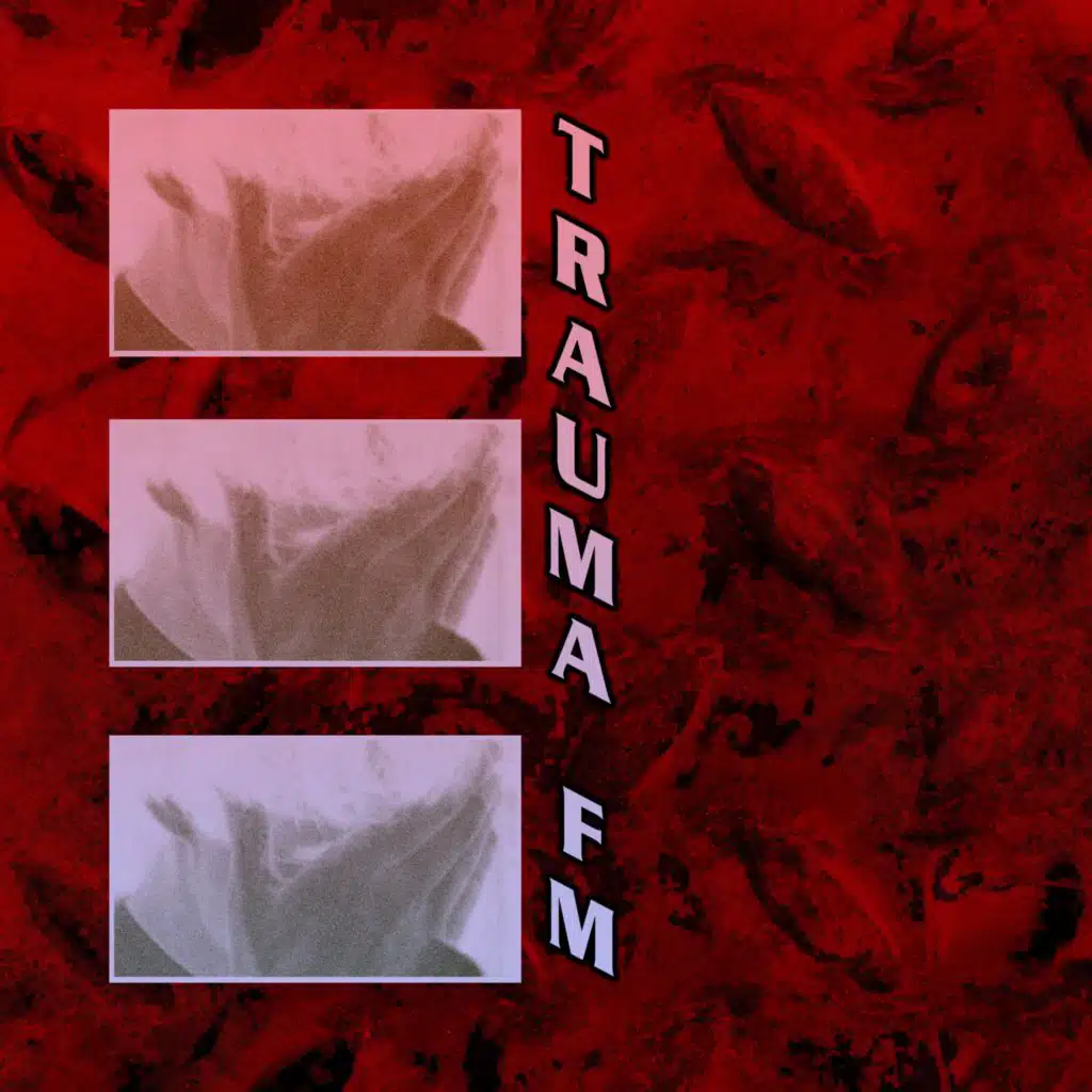 Trauma FM