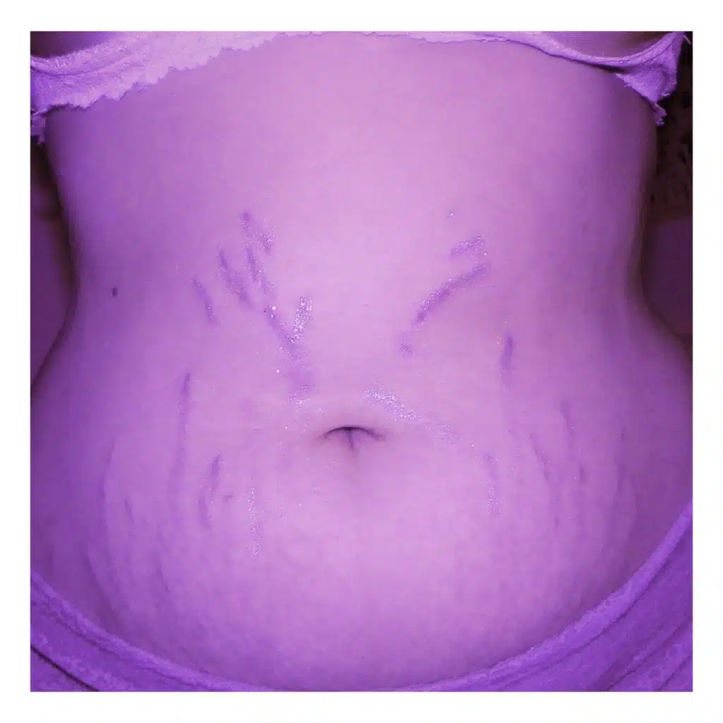 Diet Culture (Stripped)