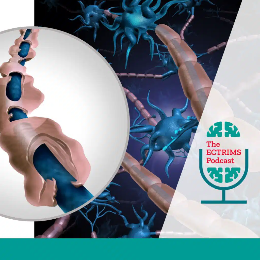 Remyelination in MS: a New Clinical Trial