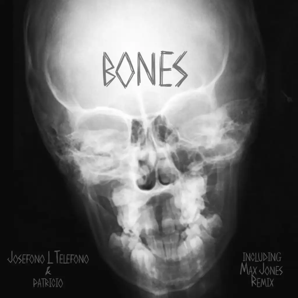 Bones (Max Jones Remix)