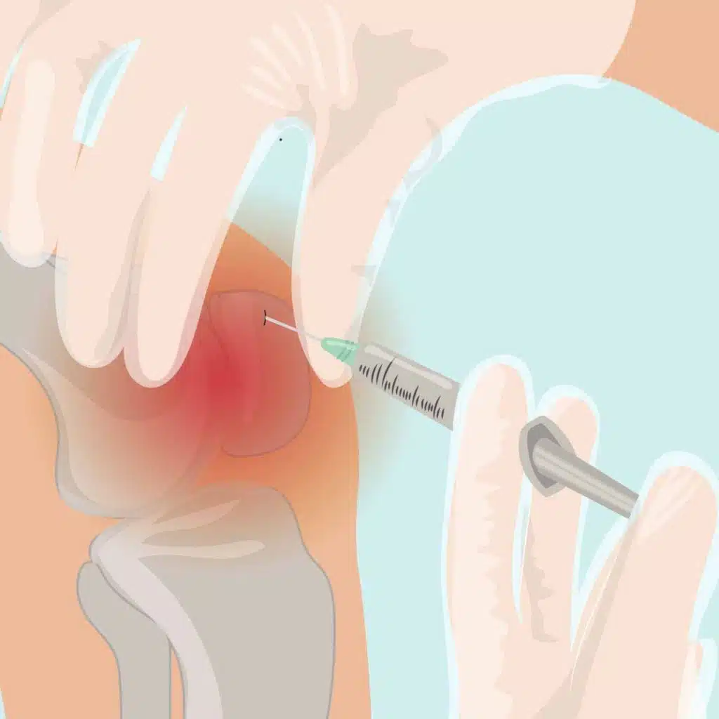 Are Cortisone Shots Safe?
