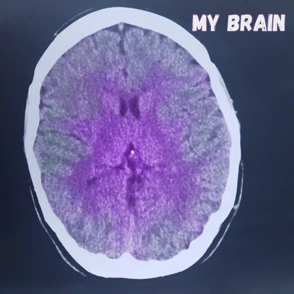 My Brain