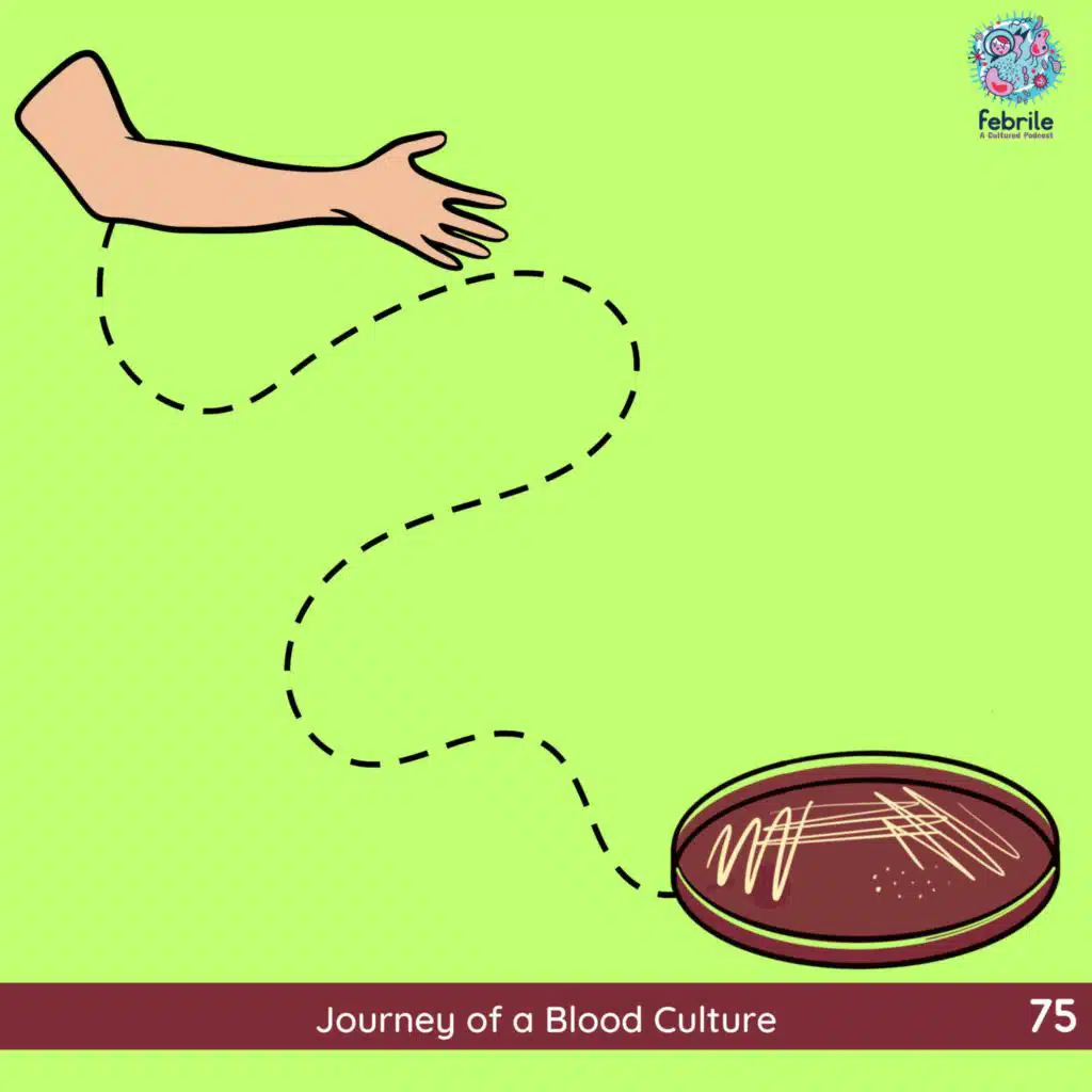 75: Journey of a Blood Culture