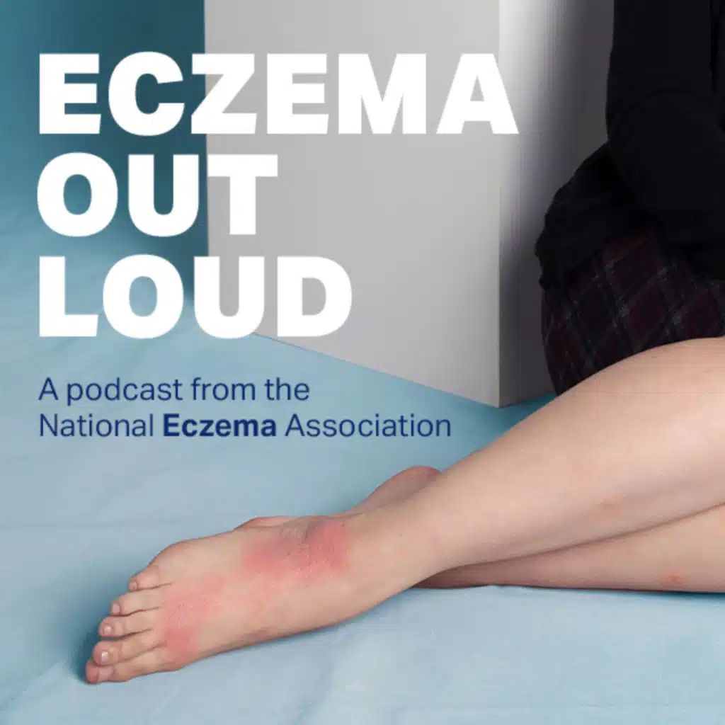 National Eczema Association