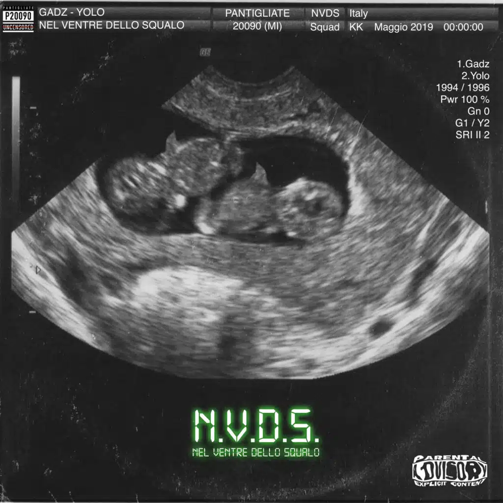 NVDS (Nel ventre dello squalo)