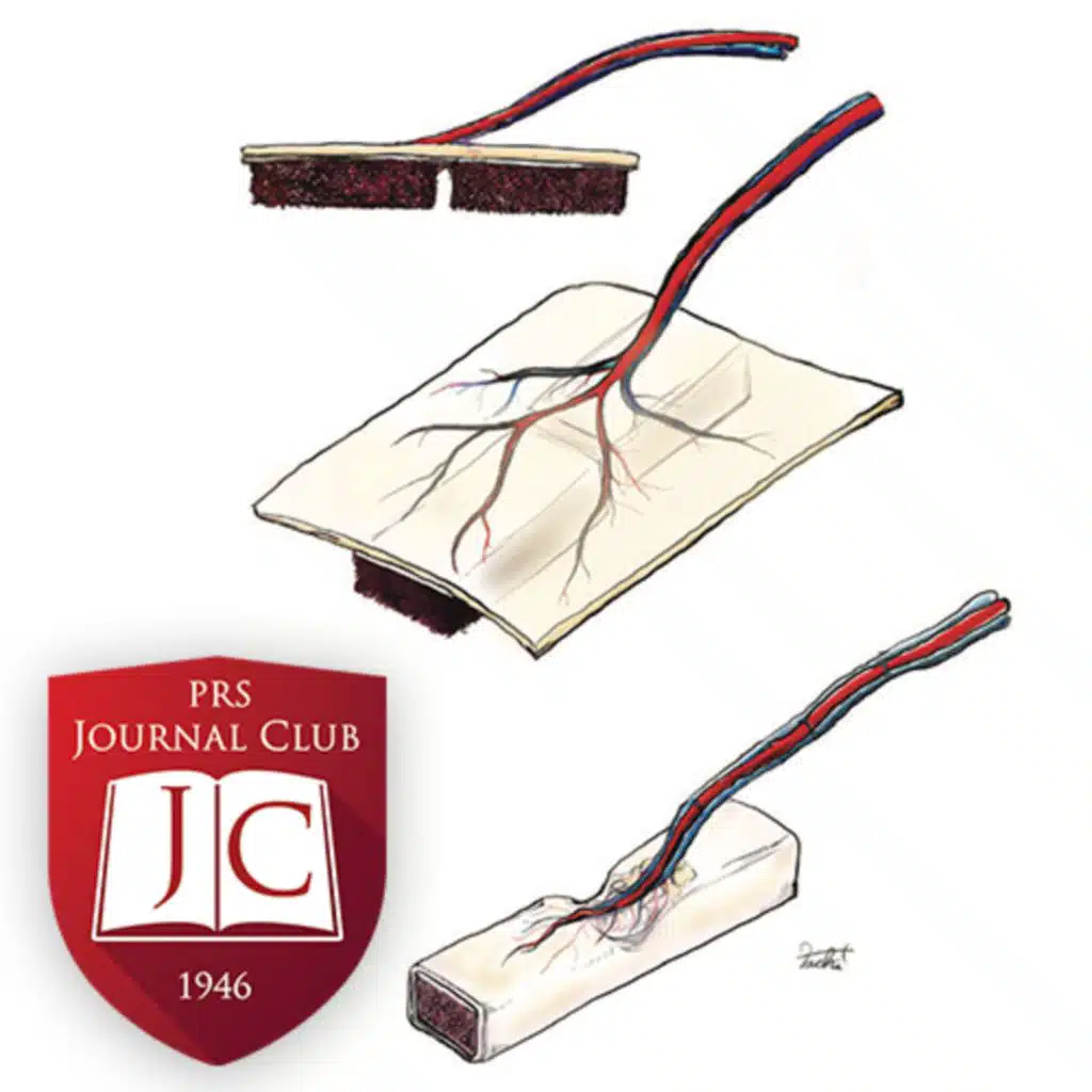 "Origami Flap Finger Joint Reconstruction" with Jeffrey B. Friedrich , MD, MC  - Dec. 2023 Journal Club