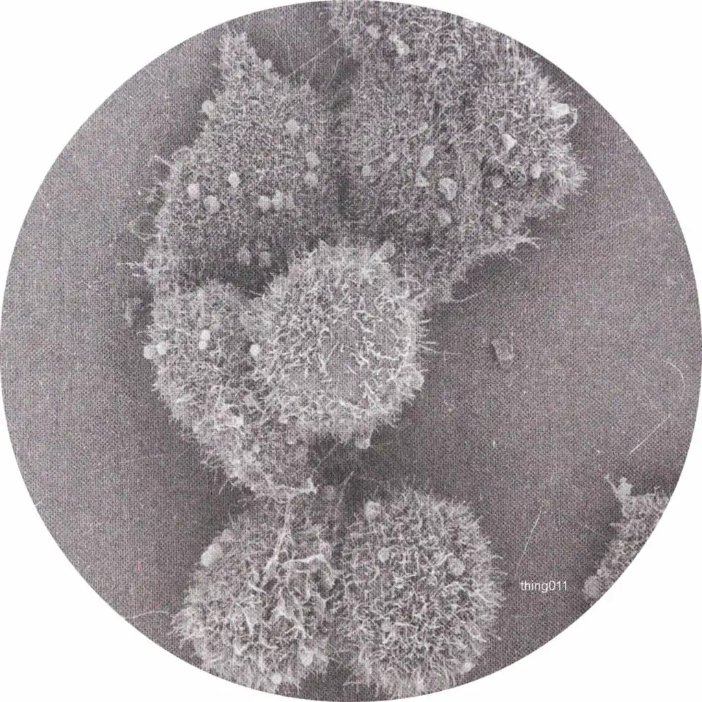 Pneumethorax