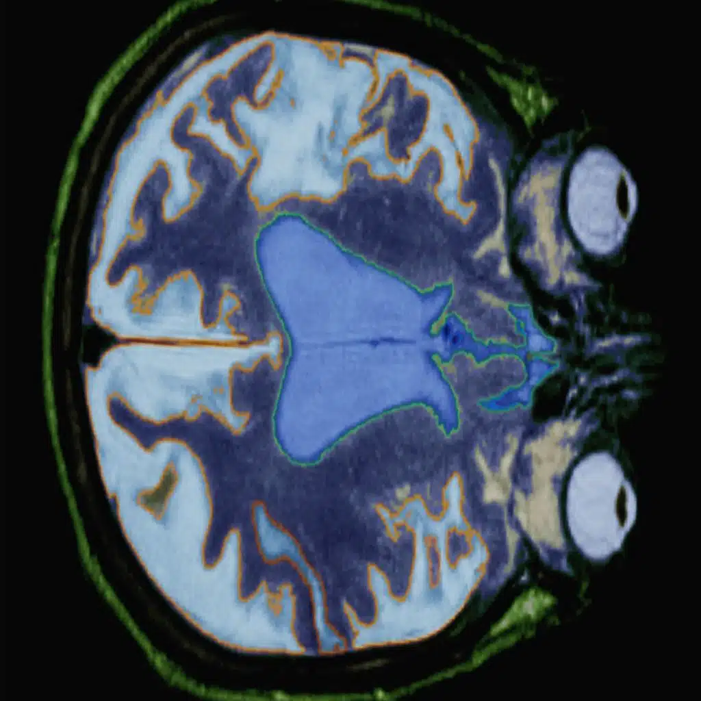 Traces of Genetic Trauma Can Be Tweaked