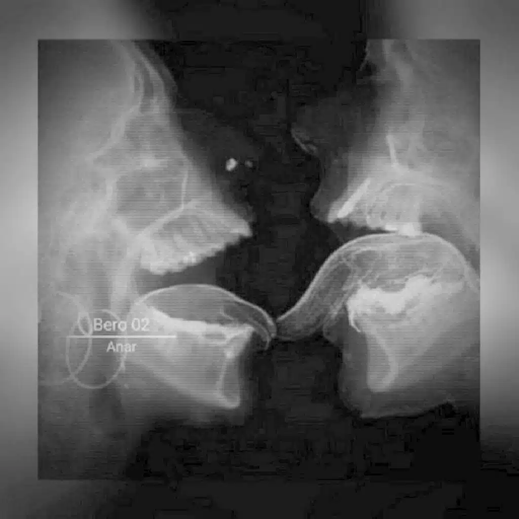 BERO 02 - Ultra Slowed