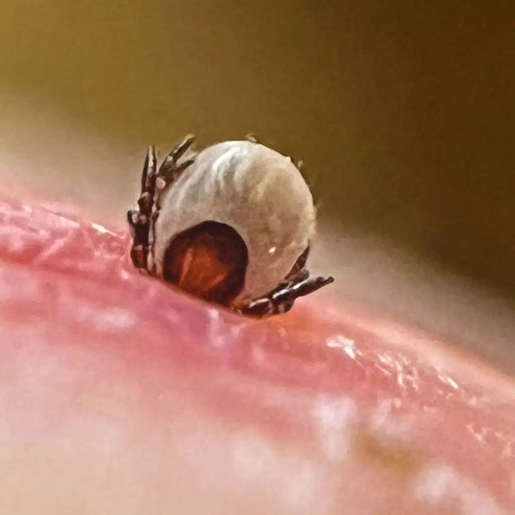 Därför kan du ha haft fästingsmittan utan att veta om det