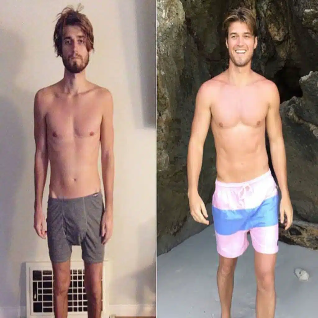 Dane Johnson - Crohn's Colitis, IBD, and Coming Back from Near Death