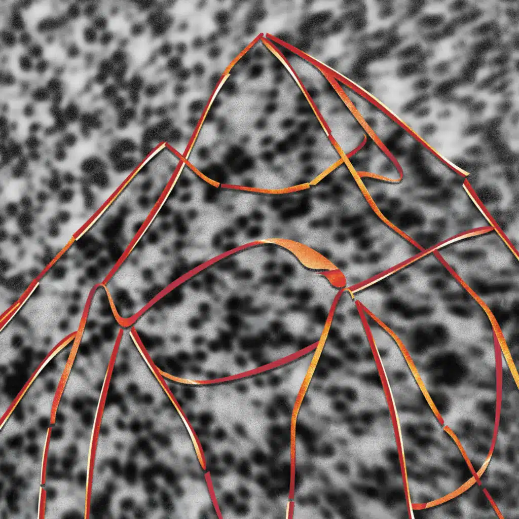 Multiples, Speedy J & Surgeon