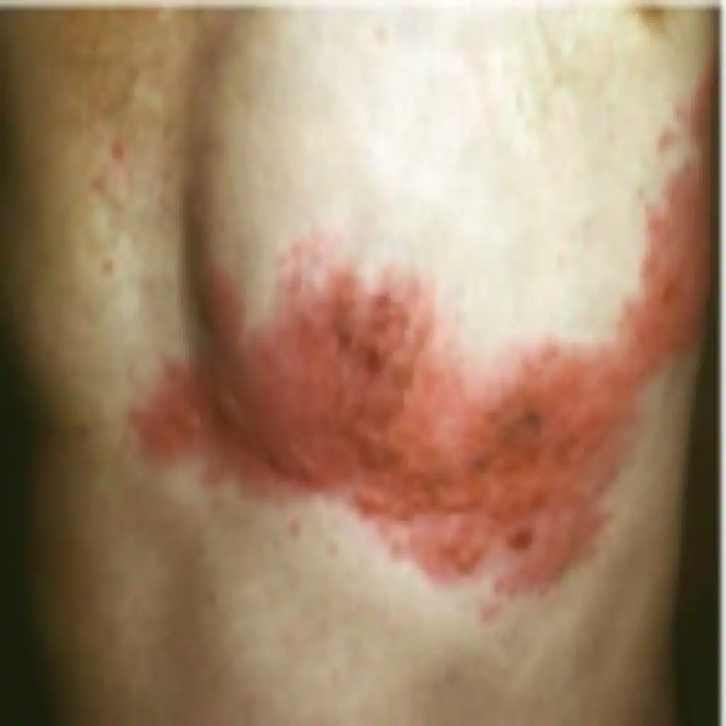 Macroscopic Skin Lesions